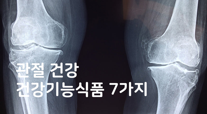 관절 건강 추천 7가지 제품